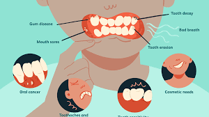 The 9 Most Common Dental Problems